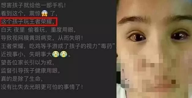 手机玩什么最伤眼睛游戏_玩手机伤了眼睛怎么办_眼睛玩手机对眼了怎么办